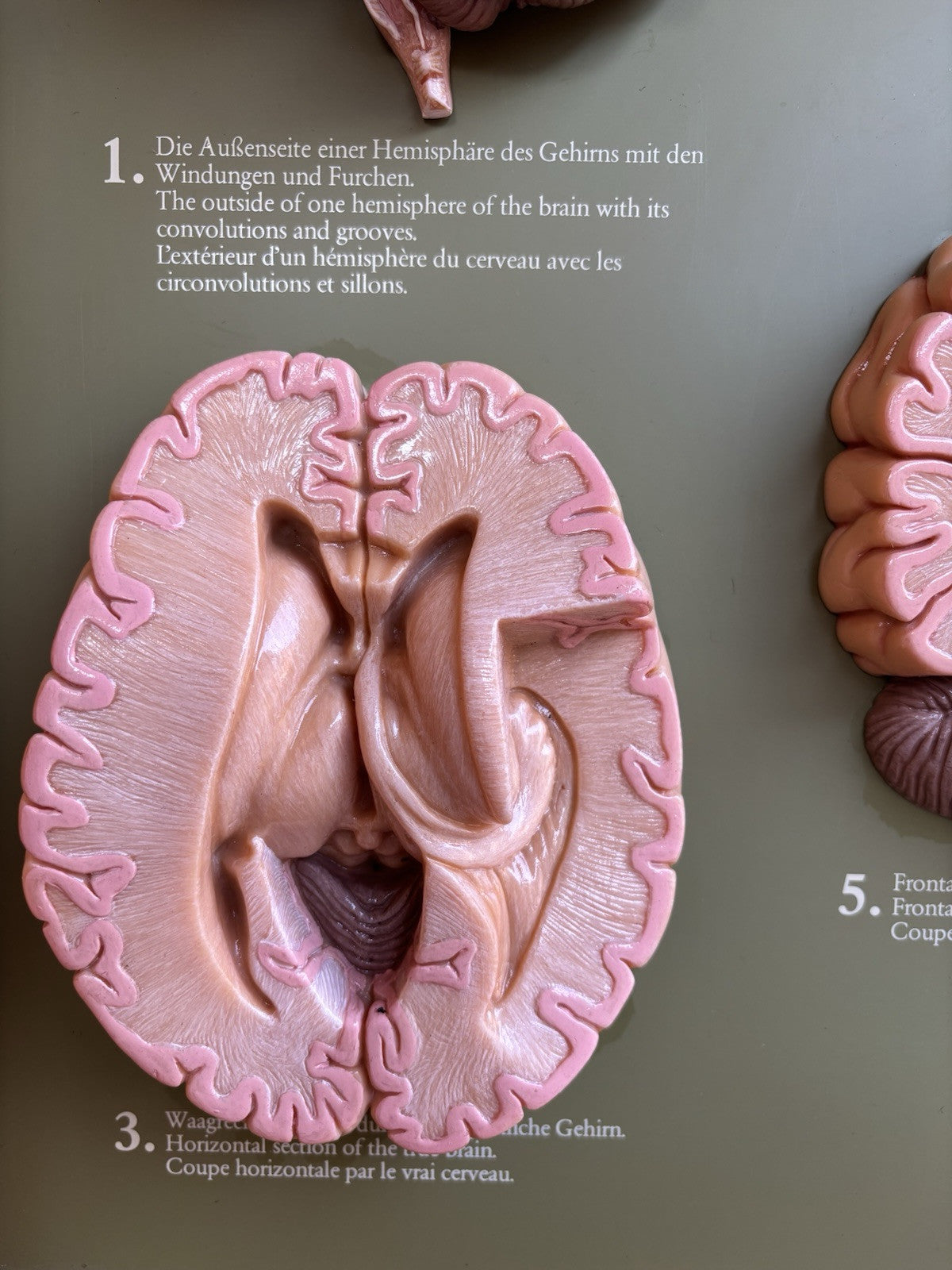 Somso- Modello Anatomico Sezioni Del Cervello- In Teca Vintage