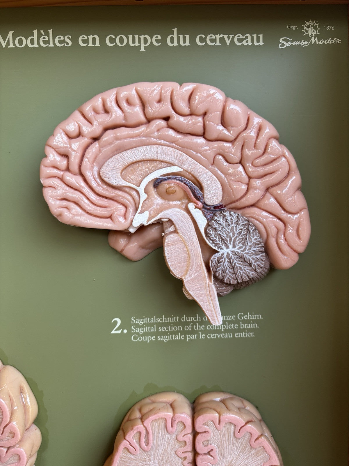 Somso- Modello Anatomico Sezioni Del Cervello- In Teca Vintage