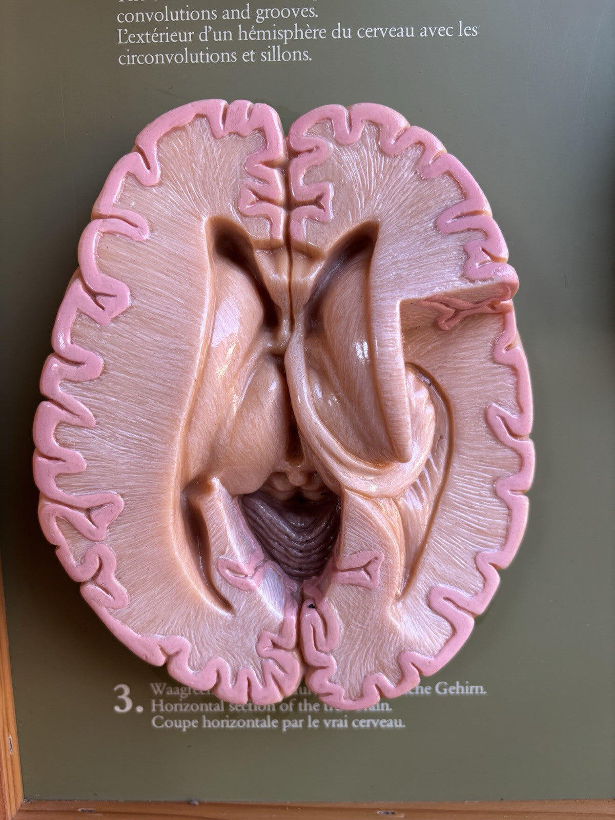 Somso- Modello Anatomico Sezioni Del Cervello- In Teca Vintage