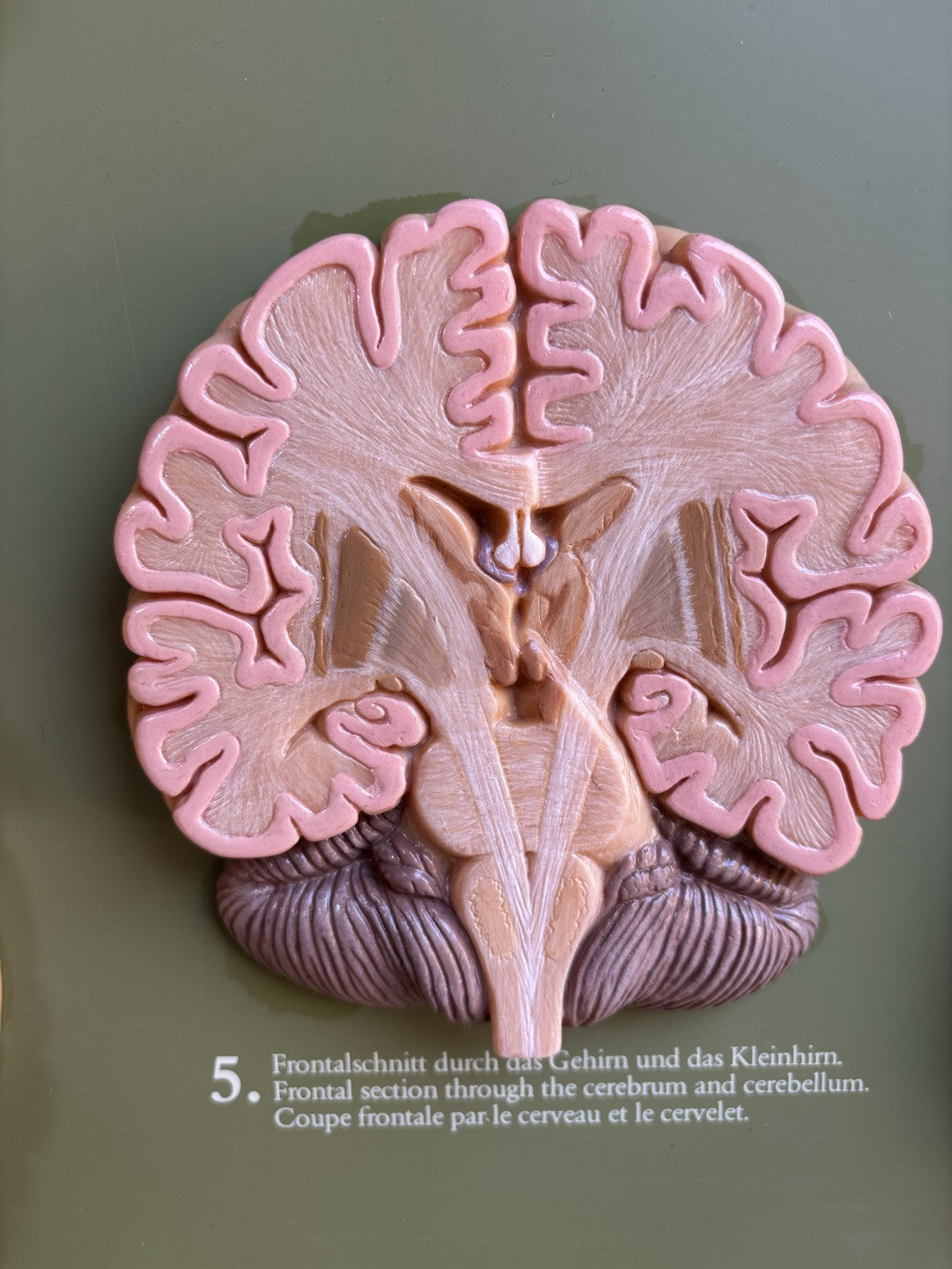 Somso- Modello Anatomico Sezioni Del Cervello- In Teca Vintage
