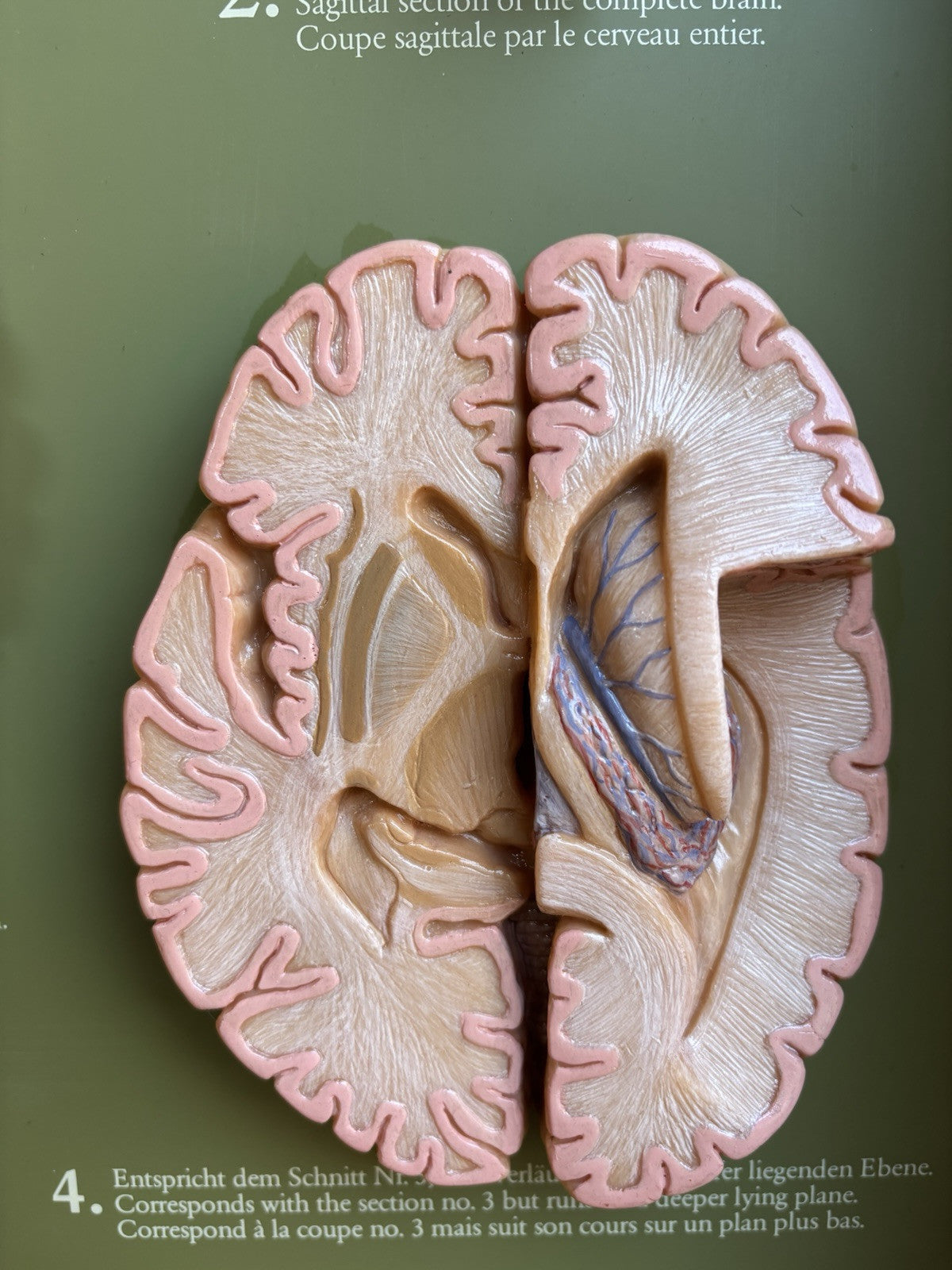 Somso- Modello Anatomico Sezioni Del Cervello- In Teca Vintage