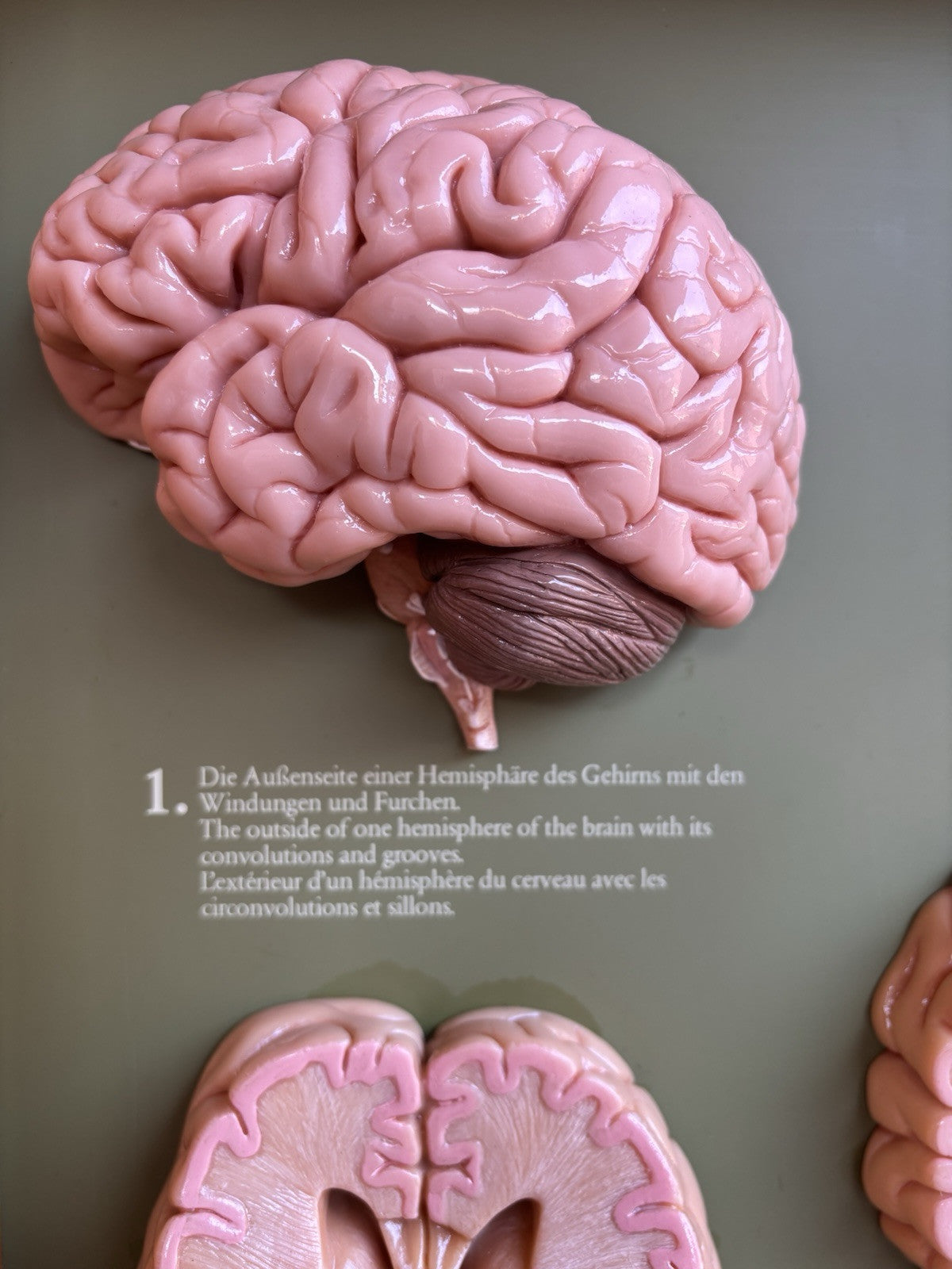Somso- Modello Anatomico Sezioni Del Cervello- In Teca Vintage