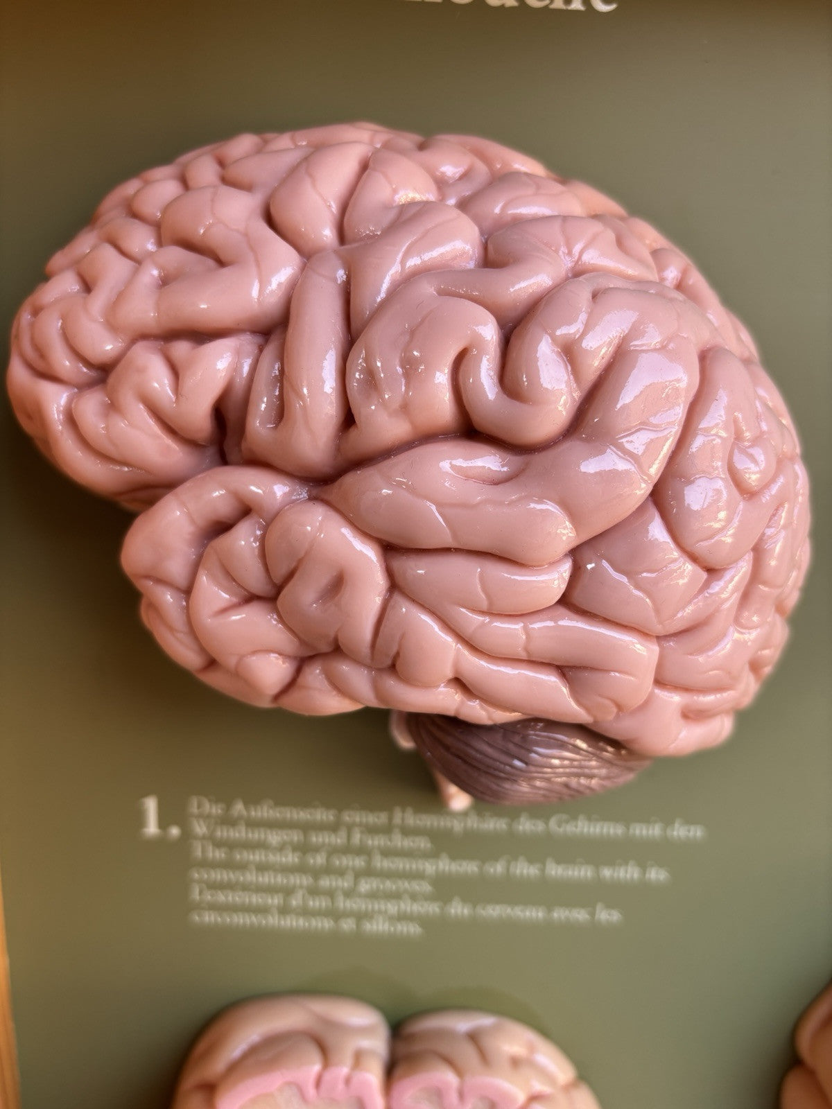 Somso- Modello Anatomico Sezioni Del Cervello- In Teca Vintage