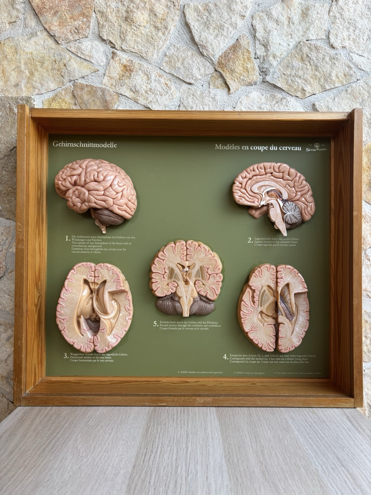 Somso- Modello Anatomico Sezioni Del Cervello- In Teca Vintage