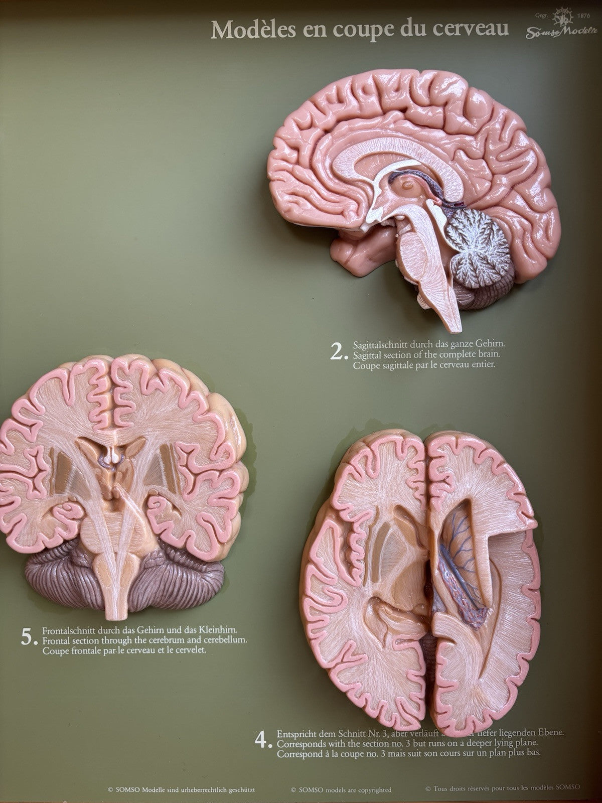 Somso- Modello Anatomico Sezioni Del Cervello- In Teca Vintage