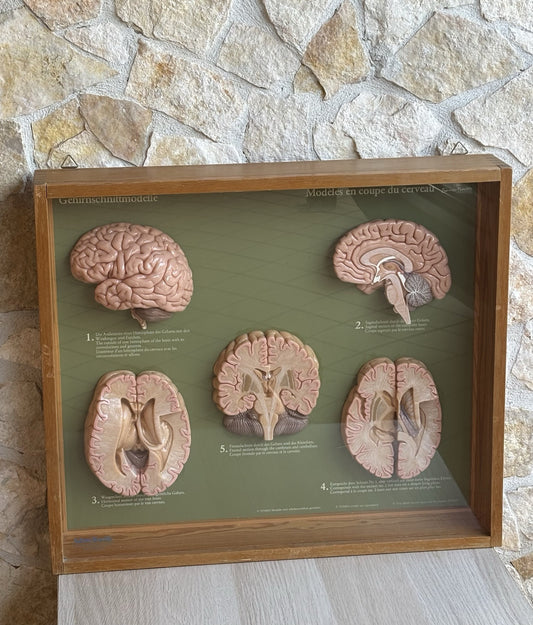 Somso- Modello Anatomico Sezioni Del Cervello- In Teca Vintage