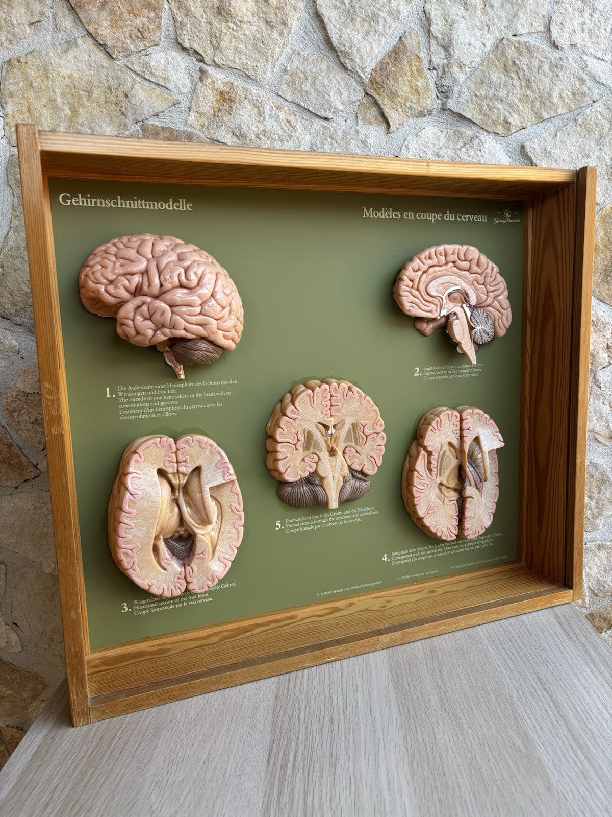 Somso- Modello Anatomico Sezioni Del Cervello- In Teca Vintage