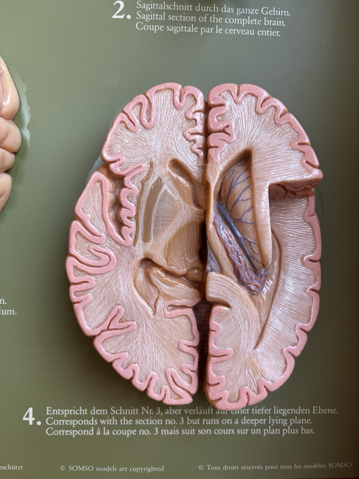 Somso- Modello Anatomico Sezioni Del Cervello- In Teca Vintage