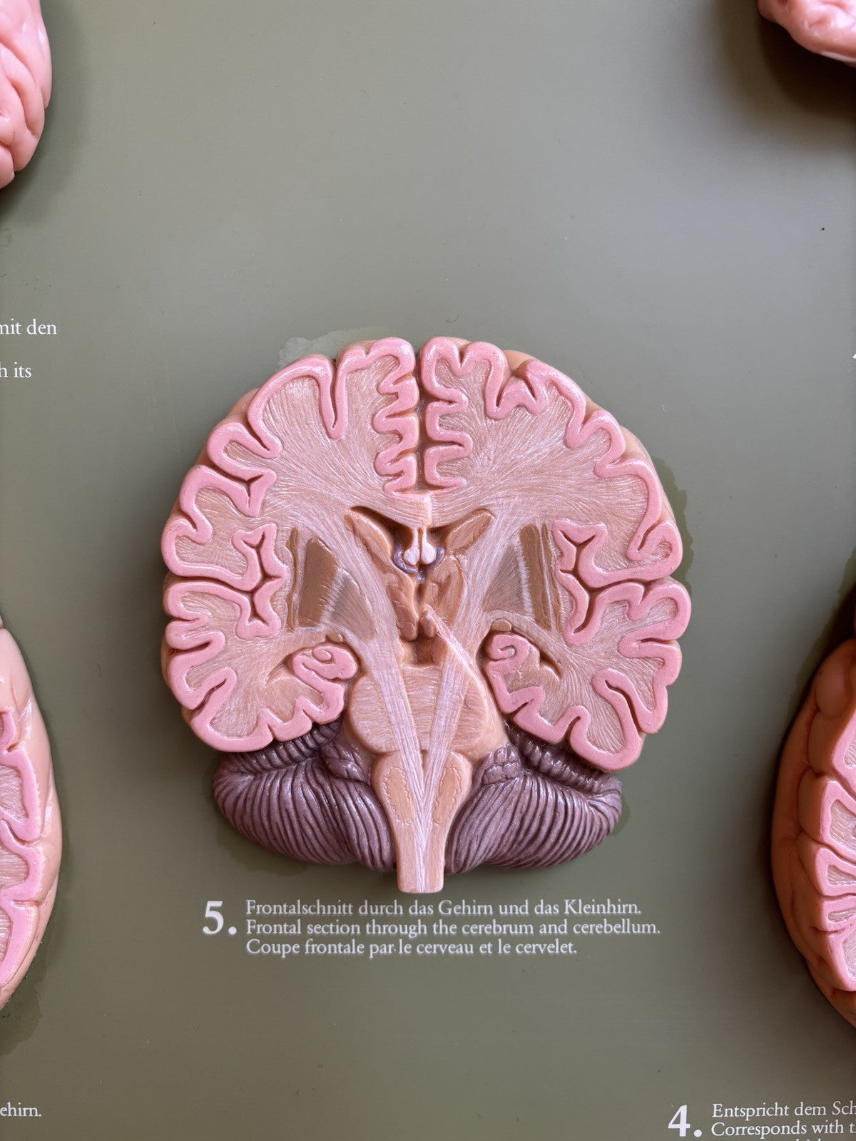 Somso- Modello Anatomico Sezioni Del Cervello- In Teca Vintage