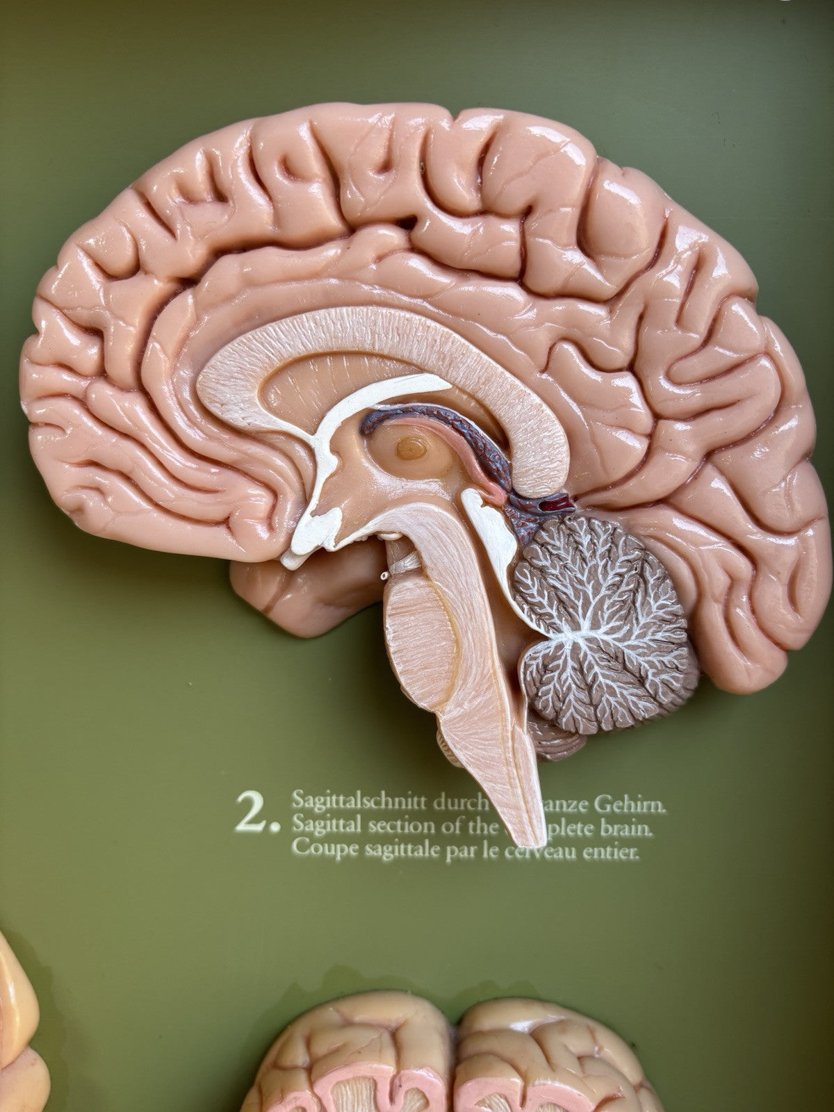 Somso- Modello Anatomico Sezioni Del Cervello- In Teca Vintage