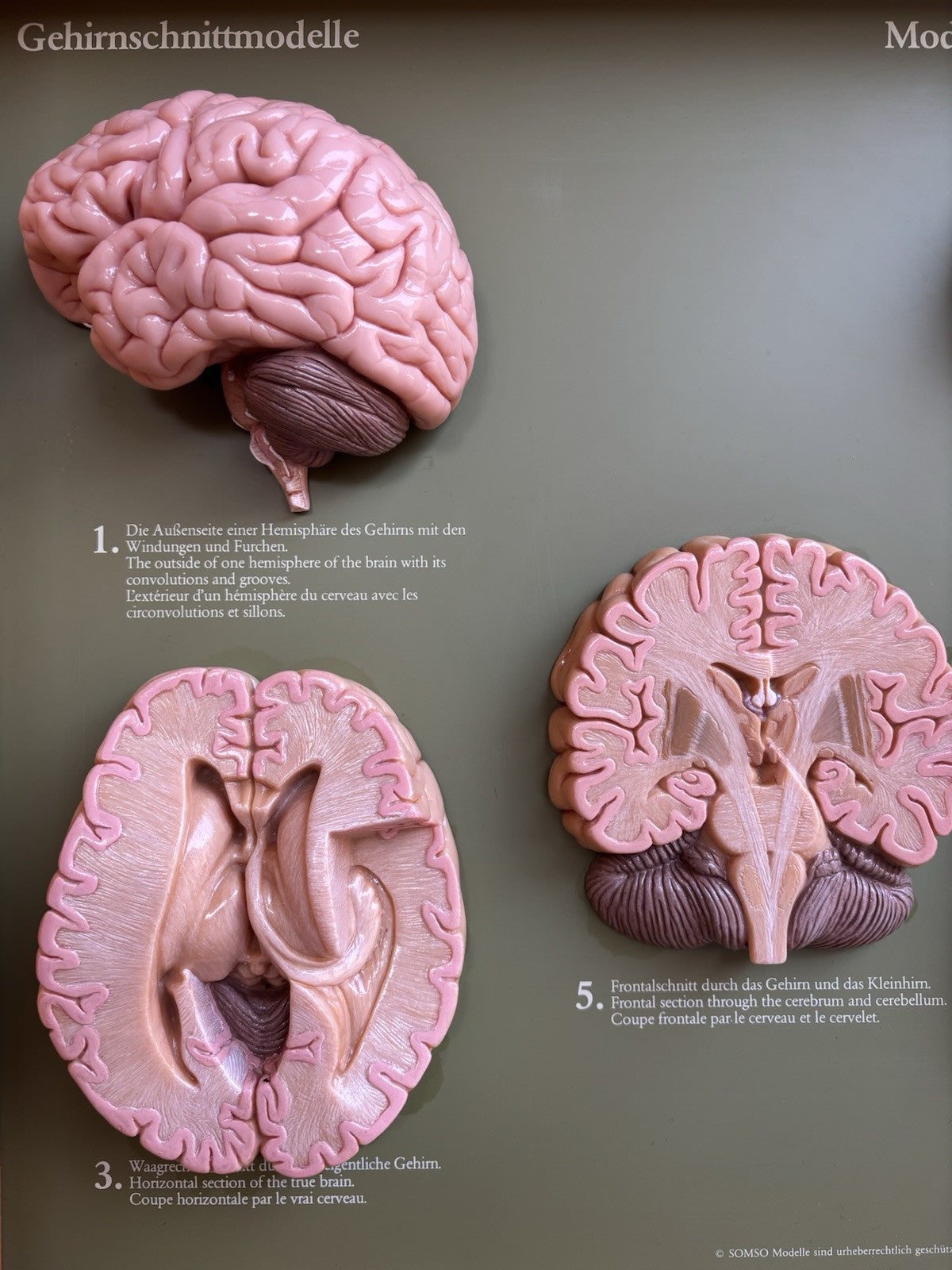 Somso- Modello Anatomico Sezioni Del Cervello- In Teca Vintage